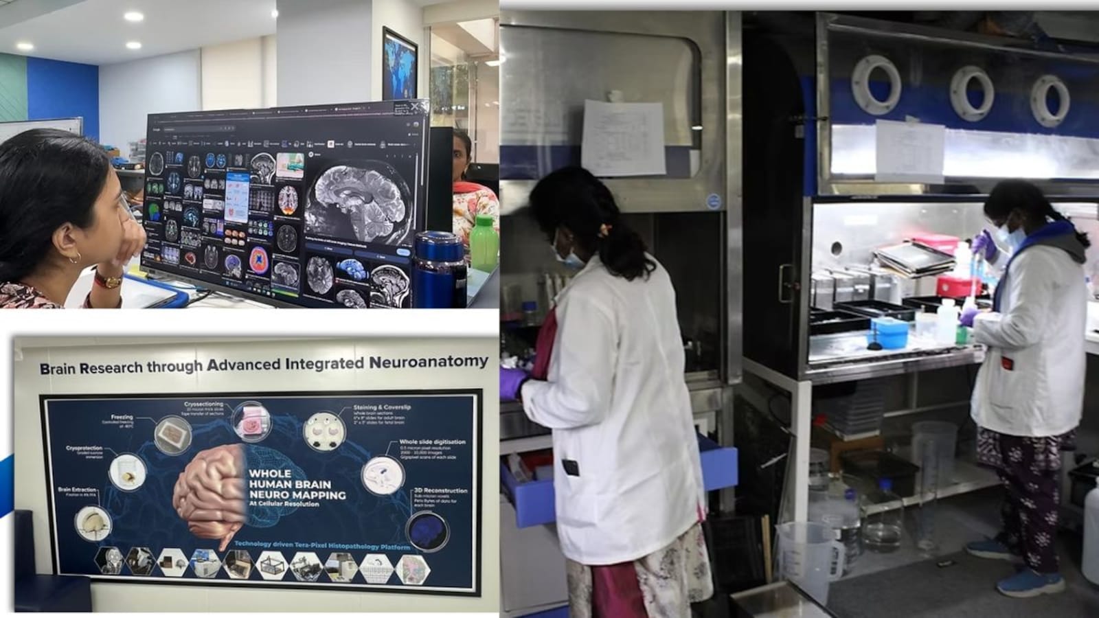 IIT Madras Maps The Human Brain By Merging Neuroscience, Engineering And Advanced Imaging