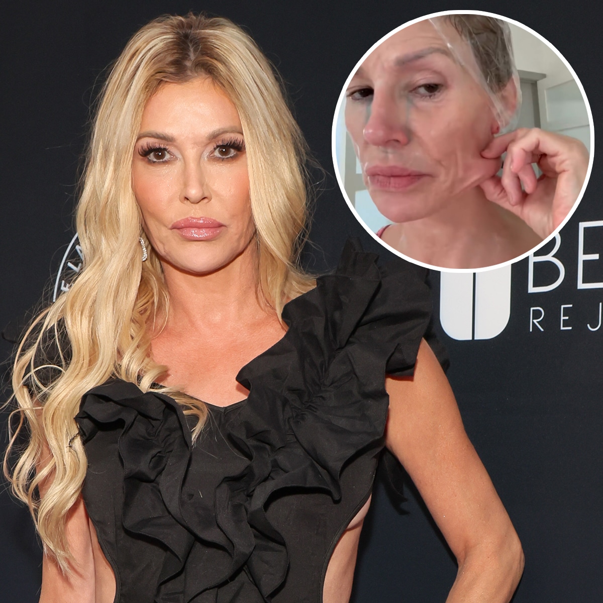 Brandi Glanville Getting Surgery to Find Out What’s “Eating” Her Face